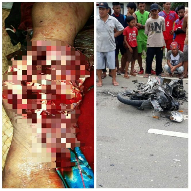 
					Sadis, Motor Lulu Lantah, Paha Pengendara Remuk di Lindas Kontainer